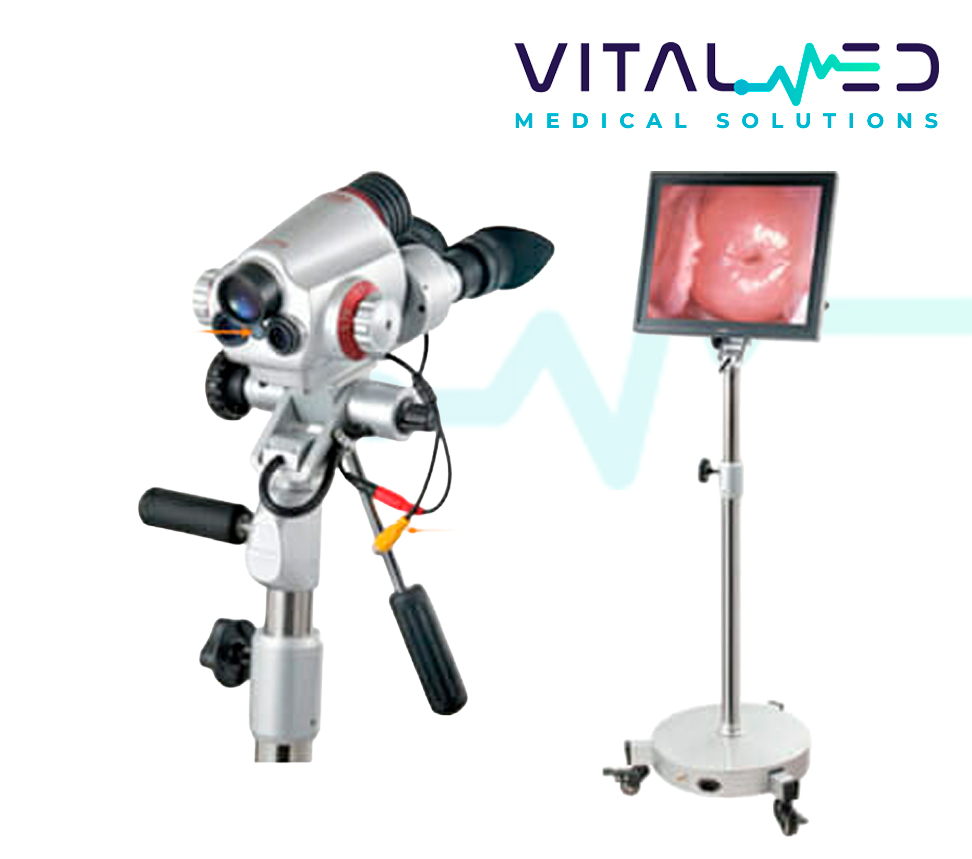 Colposcopio Digital Vital Scope