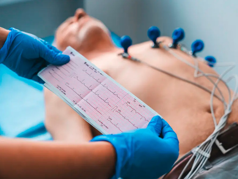 electrocardiografo