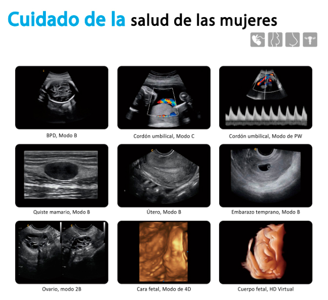 Ulrasonido CHISON QBit9