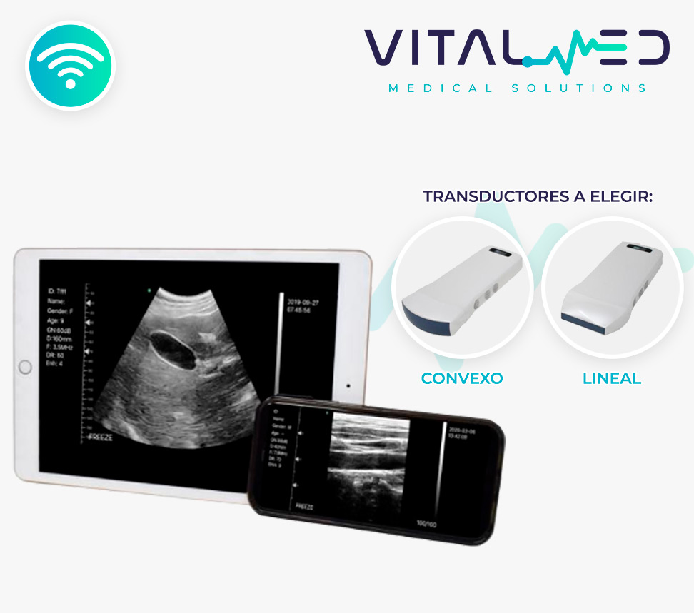 Ultrasonido WiFi