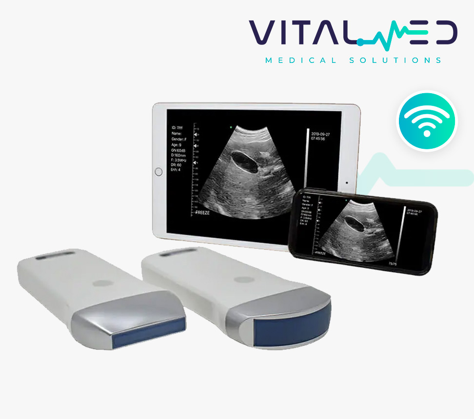 Ultrasonido_wifi_basico