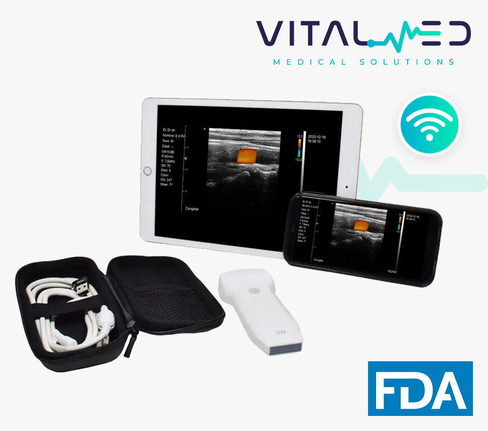 Ultrasonido WiFi Dual