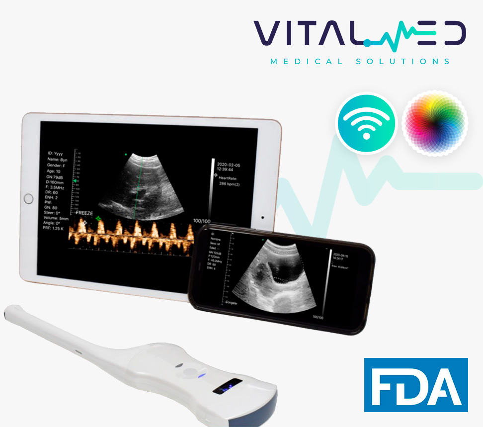 Ultrasonido_wifi_dual_doppler