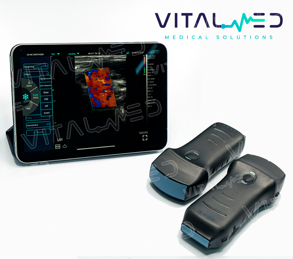 Ultrasonido wifi dual Pro convexo lineal