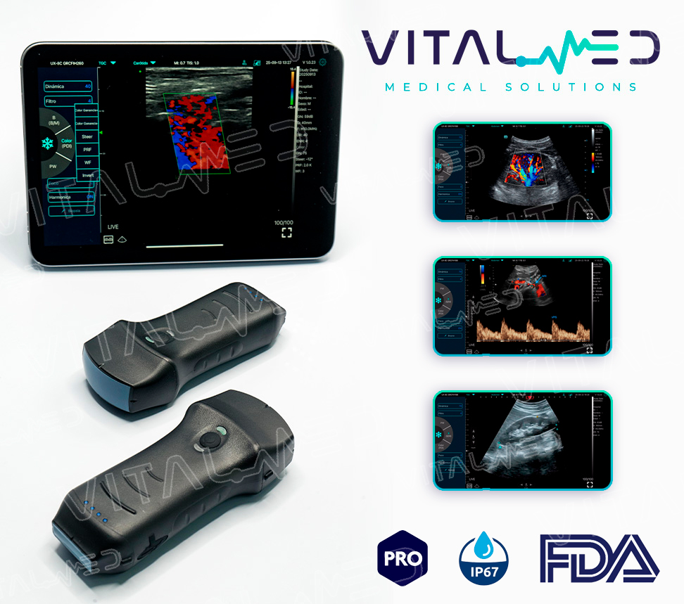 Ultrasonido WiFi Dual lineal y convexo