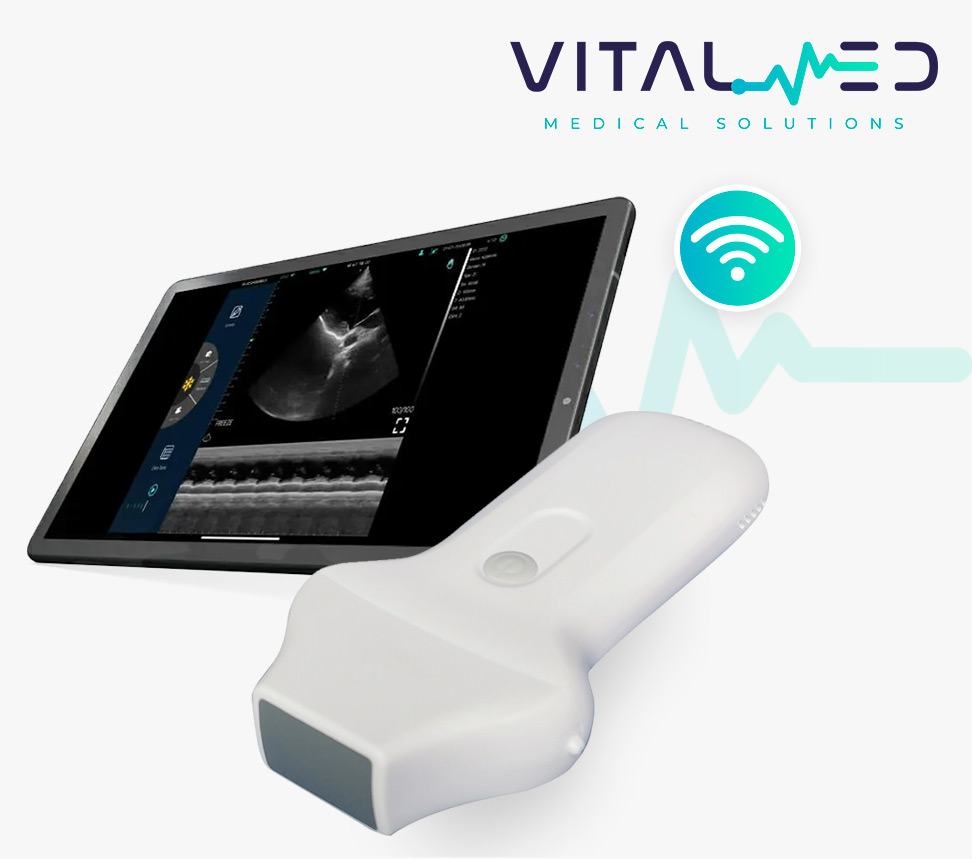 Ultrasonido WiFi Dual